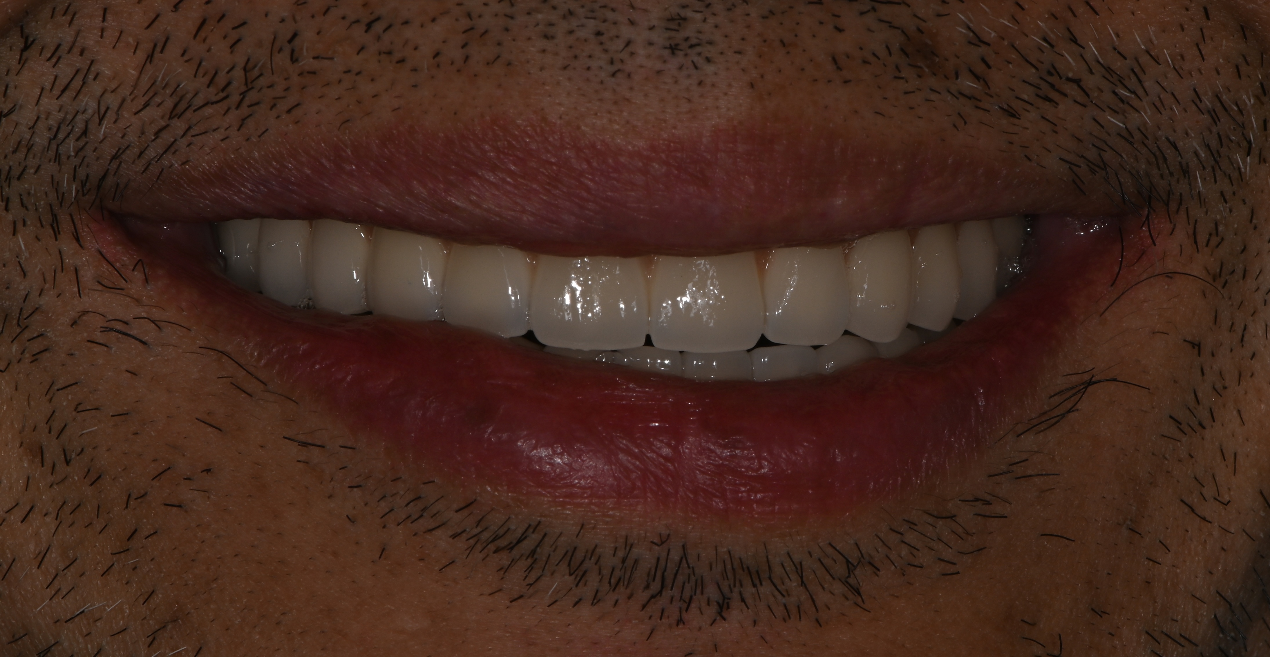 After